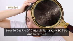 How To Get Rid Of Dandruff Naturally – 10 Tips And Remedies