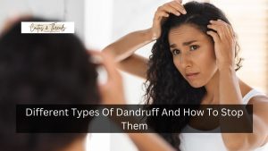 Different Types Of Dandruff And How To Stop Them