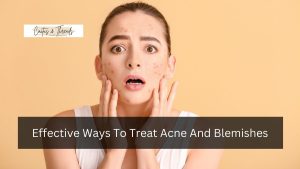 Effective Ways To Treat Acne And Blemishes