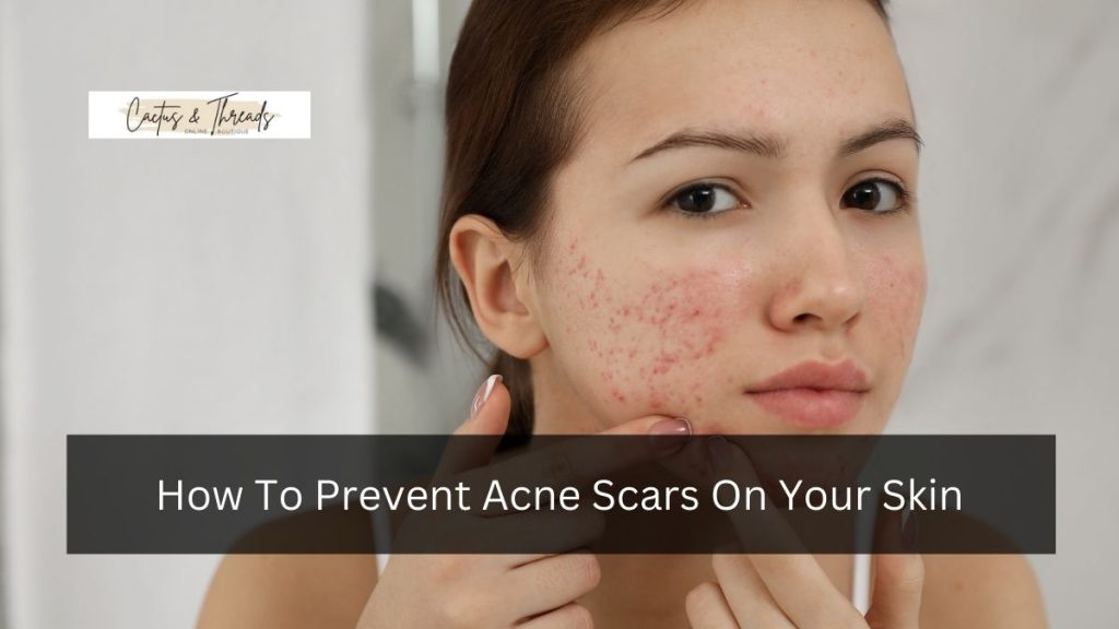 How To Prevent Acne Scars On Your Skin