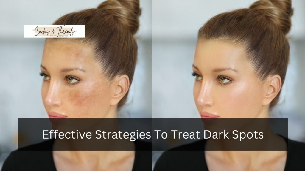 Effective Strategies To Treat Dark Spots