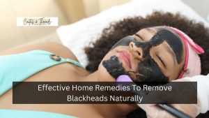 Effective Home Remedies To Remove Blackheads Naturally