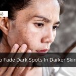 How To Fade Dark Spots In Darker Skin Tones