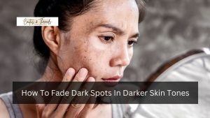 How To Fade Dark Spots In Darker Skin Tones