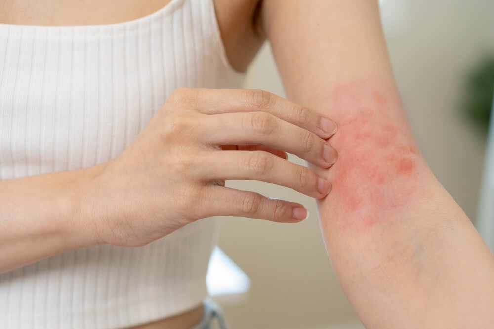 10 Symptoms & Treatments For Dry Skin