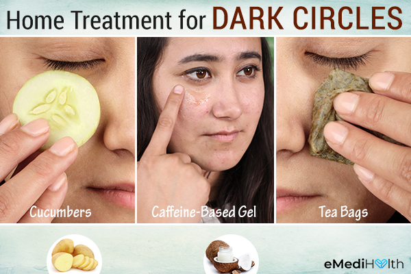 Effective Treatments For Dark Circles For A Refreshed Appearance