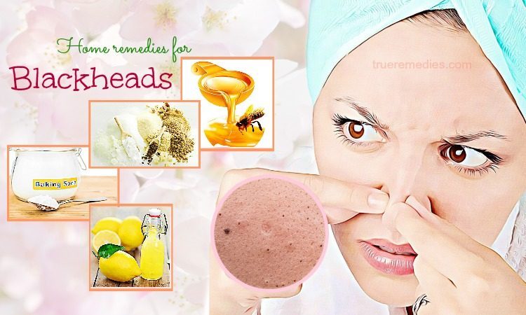 Effective Home Remedies To Remove Blackheads Naturally